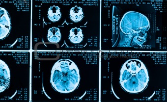 many type of brain scans with dark background