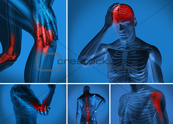 Various body pain