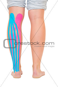 Female patients leg with applied pink and blue kinesio tape