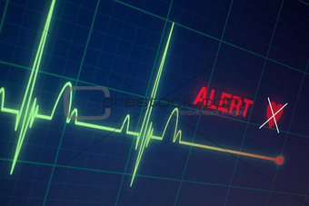 Heart beats cardiogram on the monitor.