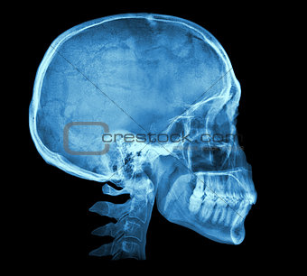 Human skull X-ray image
