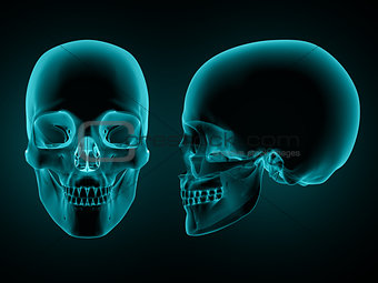 3D skull front and side on